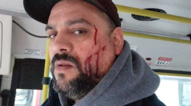Moreno: atacaron con un cúter a un colectivero tras descubrir un certificado trucho